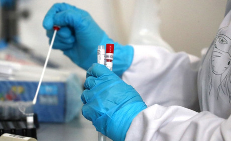 За добу в Луганській області виявили 337 хворих на COVID-19