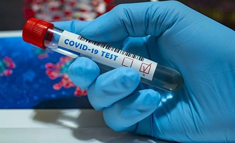 Covid-19: за тиждень діагностовано 31 новий випадок, серед хворих є дитина