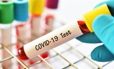 Кагарличчина: на COVID-19 хворіє 136 жителів громади