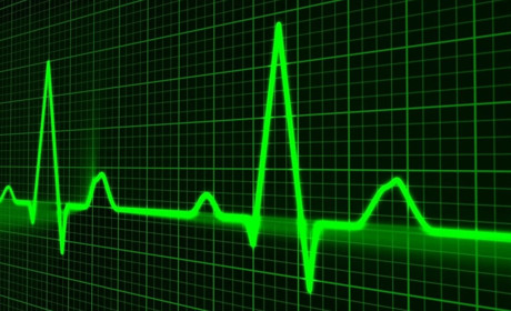 У Первомайську можна буде отримати консультацію фахівців Інституту серця: де, коли та як