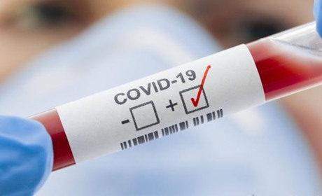 За добу на Луганщині виявили 759 хворих на коронавірусну інфекцію