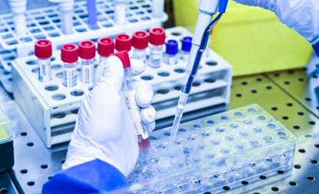 Кагарличчина: на COVID-19 хворіє 276 жителів громади