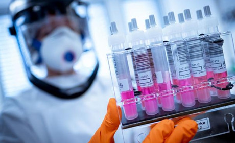 Кагарличчина: на COVID-19 хворіє 173 жителі громади