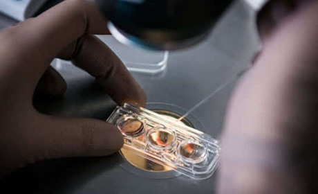 Лікування безпліддя у жінок у Києві ефективними методами в Інституті Генетики Репродукції