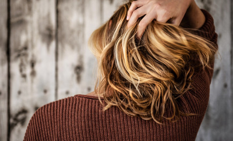 Випадіння волосся: причини, міфи, лікування