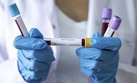 За добу виявили шість нових випадків захворювання на коронавірусну інфекцію