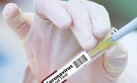 Ковідна статистика: за новорічні вихідні у Первомайській ЦРЛ померли 4 людини
