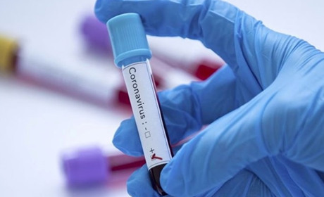 COVID-сертифікат для щеплених бустерною дозою від коронавірусної хвороби з'явиться наприкінці січня