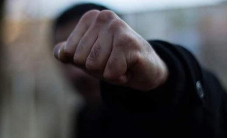 Поліцейський Чернігівського райуправління знущався над затриманим, — Державне бюро розслідувань
