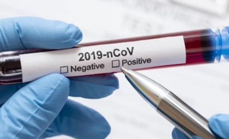 За добу на Луганщині виявили 207 хворих на коронавірусну інфекцію