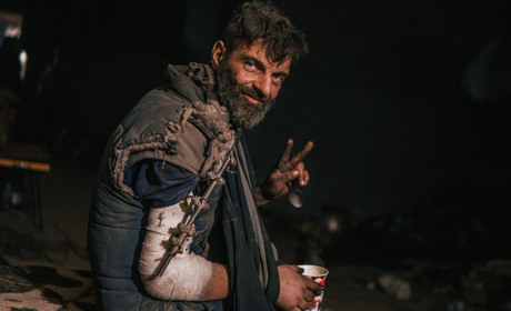 Азовці опублікували фото поранених бійців, щоб показати усьому світу умови, в яких вони перебувають