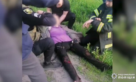 Жінці з Торецька перебило осколками обидві ноги – поранену рятували парамедики