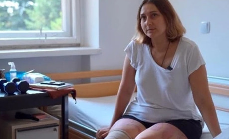 Жінці з Гуляйполя, що втратила ногу через обстріли, відновили можливість ходити