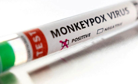 ВООЗ ОГОЛОСИЛА СПАЛАХ МАВПЯЧОЇ ВІСПИ НАДЗВИЧАЙНОЮ СИТУАЦІЄЮ МІЖНАРОДНОГО МАСШТАБУ