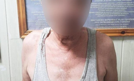 Наніс ножові поранення: на Вознесенщині затримано 65-річного чоловіка