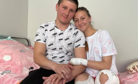 Лисичанка, яка втратила обидві ноги, проходить реабілітацію в Німеччині. Історія одужання