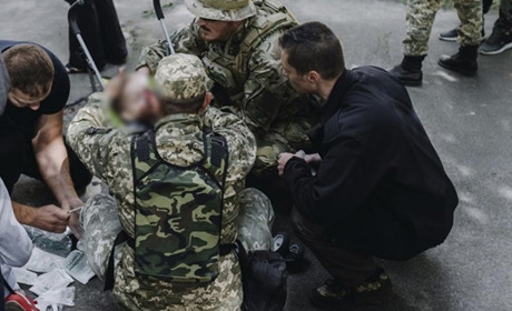 Перев'язували обличчя та перевіряли чи цілі органи: як волонтер та військовий рятували Рому на Валу
