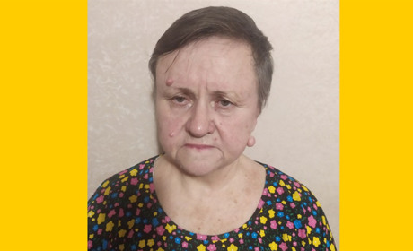 Первомайчанці необхідне ендопротезування суглобів: родина звернулася по підтримку до небайдужих