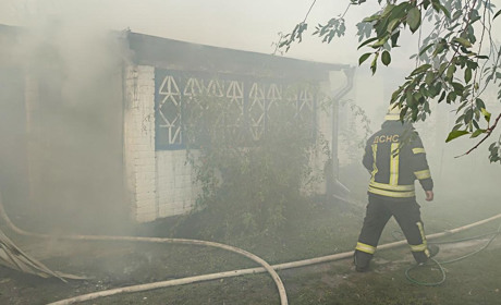 Пожежа в Шубівці Кагарлицької МТГ: господар отримав опіки