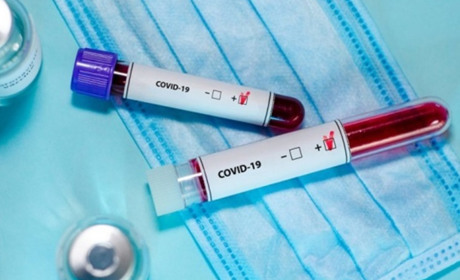 За тиждень на Covid-19 захворіло 44 людини