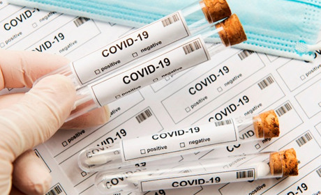 Не їсти та не чистити зуби, а ще відмовитись від алкоголю? Що не можна робити перед ПЛР-тестом