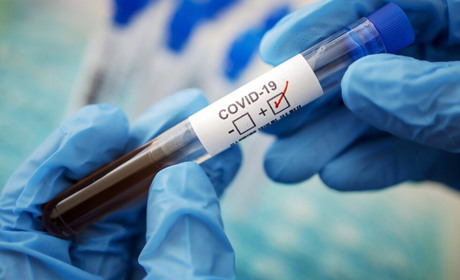 В Южне повертається ковід, зареєстрували летальний випадок