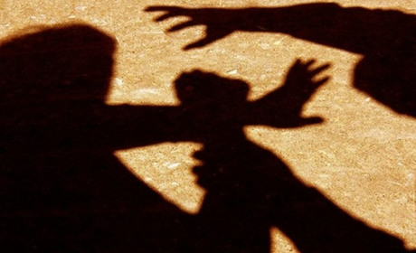 В Одесі випадковий перехожий ледве не вбив чоловіка, який просив його припинити лайку