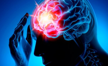 Лікарні Хмельниччини мають договір з НСЗУ на “інсультний пакет”: де та які послуги можна отримати