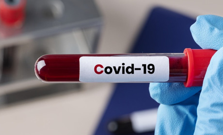 На Полтавщині фіксують зниження захворюваності на COVID-19