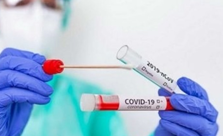 Коронавірус на Полтавщині: яка ситуація з рівнем захворюваності
