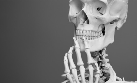 Остеопороз: кому він загрожує та як зміцнити кістки