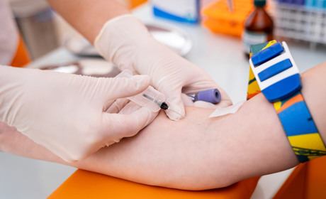 У Ржищеві за біохімічні дослідження крові доведеться платити. Але не всім