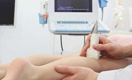 Як лікувати варикозне розширення вен