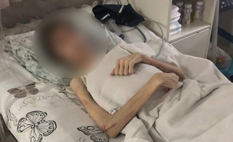 Батькові, який ледь не заморив сина голодом, присудили рік випробувального терміну