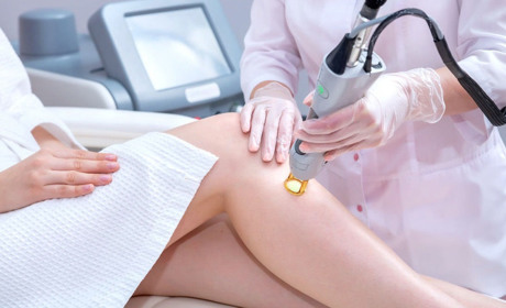 Які існують апарати для лазерної епіляції?