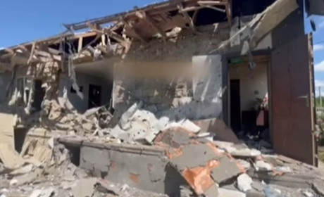 Внаслідок обстрілів Дніпрян загинула дитина