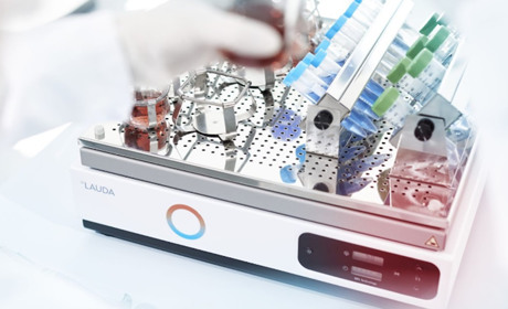 Що таке лабораторний шейкер та які його види можна купити в Україні