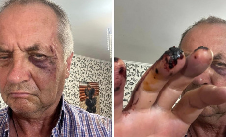 В Ананьєві побили головного редактора місцевої газети. Журналіст пов'язує напад зі своєю діяльністю