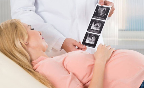 Коли і навіщо роблять УЗД під час вагітності