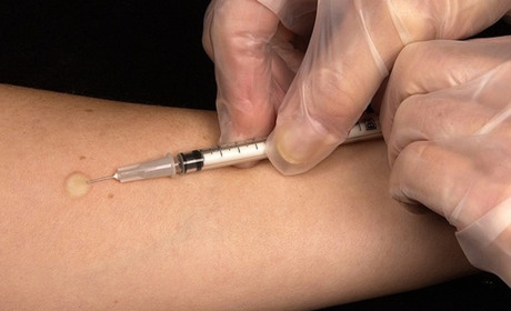 На Хмельниччині вакцинують більше 11 тисяч дітей проти кору, паротиту і краснухи