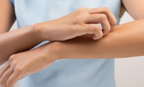 Свербіж та почервоніння шкіри: чому виникає та поради по зниженню неприємних відчуттів