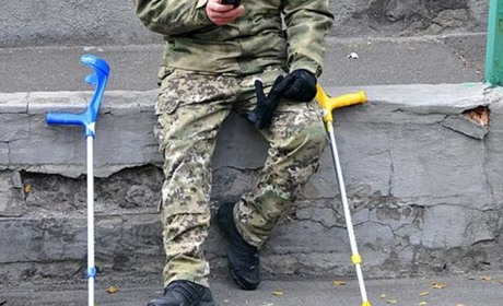 Естонія допоможе створити Центр реабілітації та протезування на Житомирщині, – Арсеній Пушкаренко