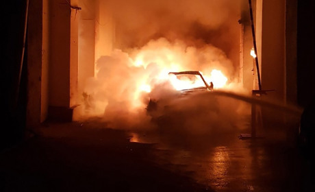 В пожежі на Звягельщині постраждала власниця приватного будинку — її врятували вогнеборці