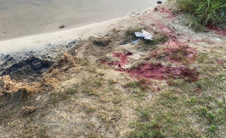 Смерть дитини від обстрілів в Костянтинівці. Ще четверо дітлахів поранені