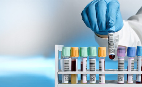 Щорічний чек-лист. Які аналізи необхідно здавати, щоб перевірити здоров’я