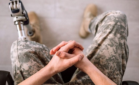 Табу для цивільних у спілкуванні і протезування: як військовим із ампутаціями адаптуватися у соціумі