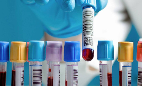 Щоб бути у формі: які аналізи та обстеження потрібно робити чоловікам і жінкам кожного року