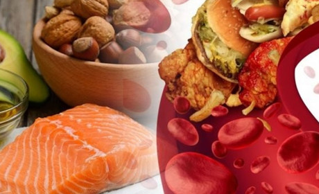 Як ефективно знизити високий холестерин