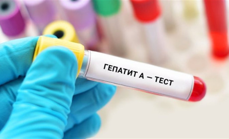 В Україні спалах гепатиту А: як передається і як вберегтися від зараження? Ситуація на Переяславщині