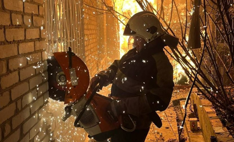 У Фастові під час пожежі ледь не загинув відомий лікар: що відомо